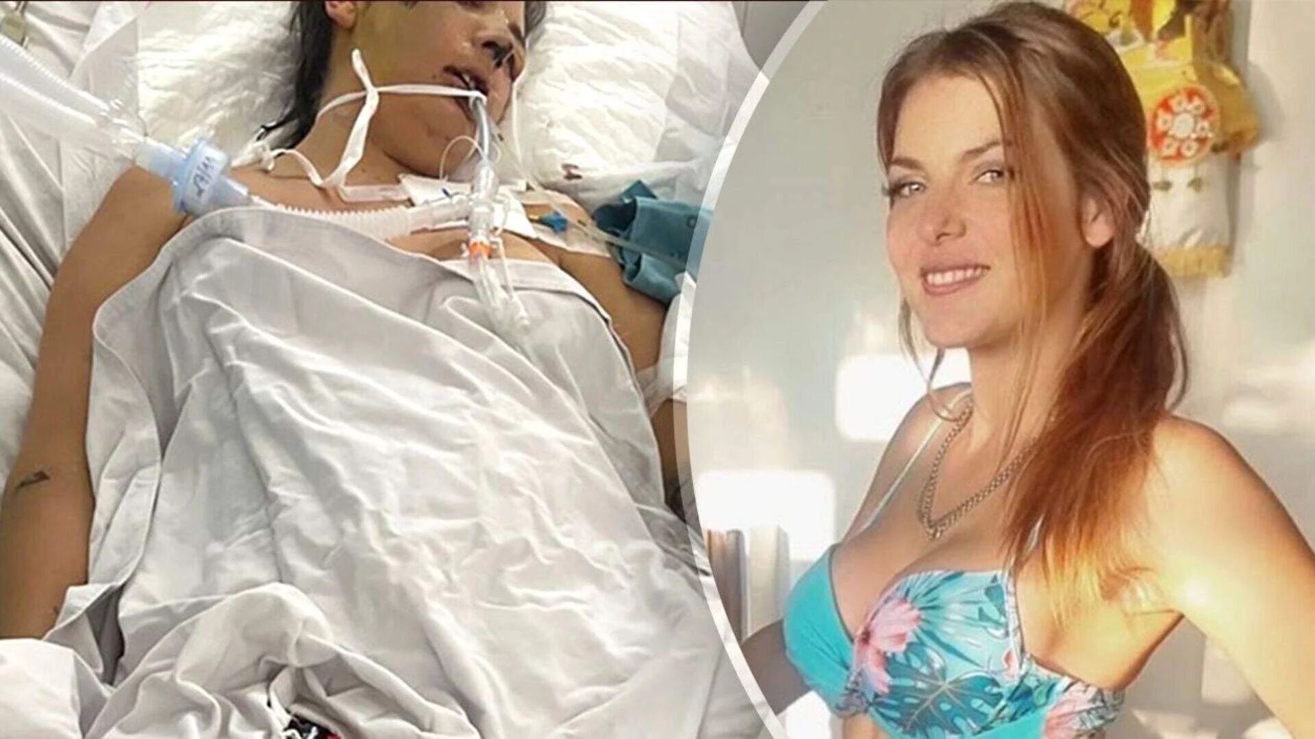 Droomreis eindigt in nachtmerrie: Moeder (31) in coma na routine-ingreep