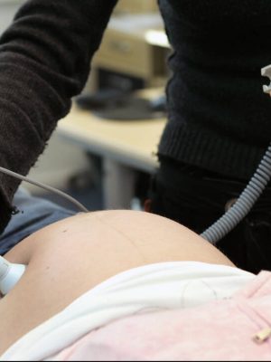 Carola’s gezicht veranderde drastisch na zwangerschap: ‘Ze noemden me een konijn’