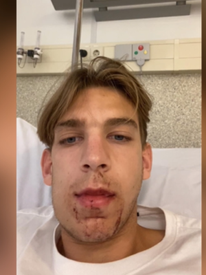 Tijn (23) uit Valkenswaard loopt marathon als sportieve revanche op zware mishandeling